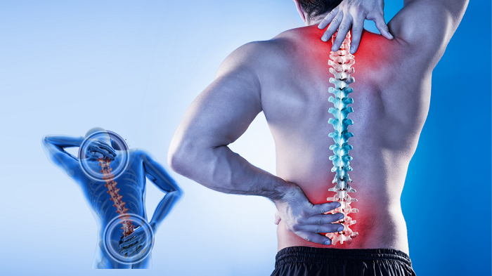 Alleviating Back Pain Naturally with Ayurveda Treatment