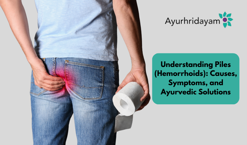 Understanding Piles (Hemorrhoids): Causes, Symptoms, and Ayurvedic Solutions
