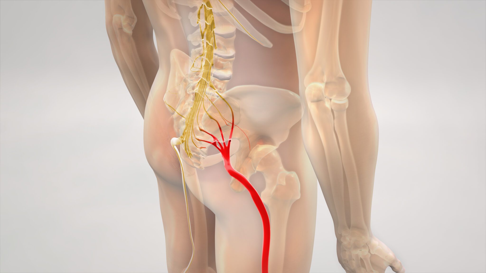 Sciatica Treatment In Noida